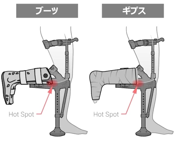 アイウォーク3.0（iWALK3.0）[ハンズフリー松葉杖・ニークラッチ