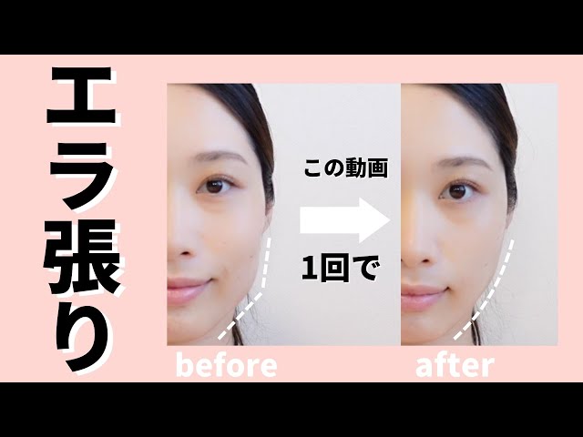 No need for Botox! Transform your face line in just one session