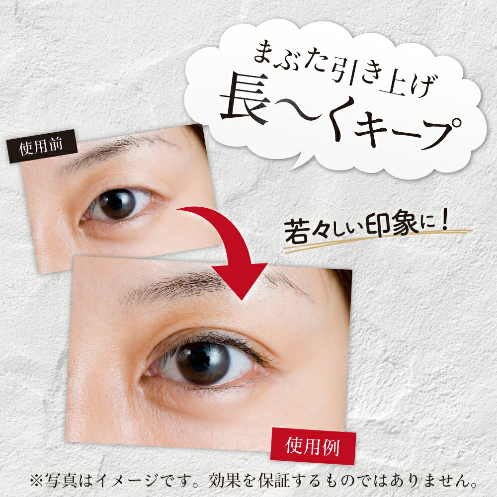 楽天市場】視界良好DX まぶた引き上げジェル 2ml ◇ まぶた たるみ 二