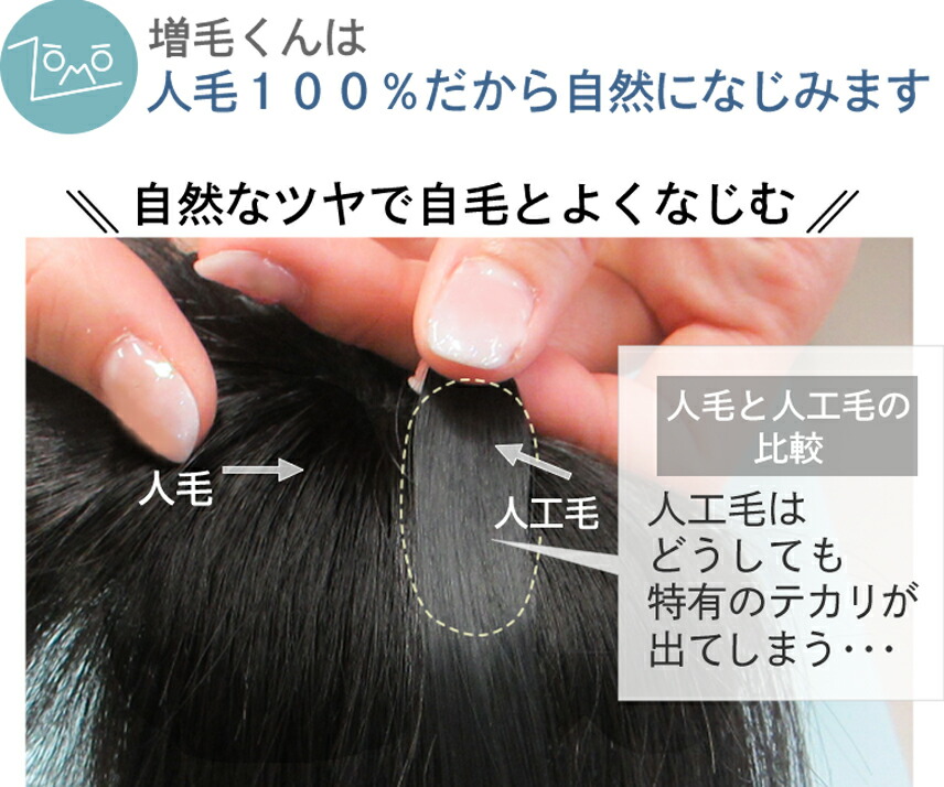 楽天市場】生え際全体にプラス！増毛くんシリーズはえぎわくん【S