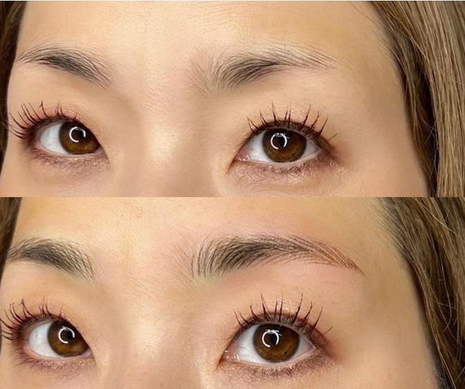 アートメイク眉〈フェザーナノブロウ〉 | ヤヨイクリニック(YAYOI