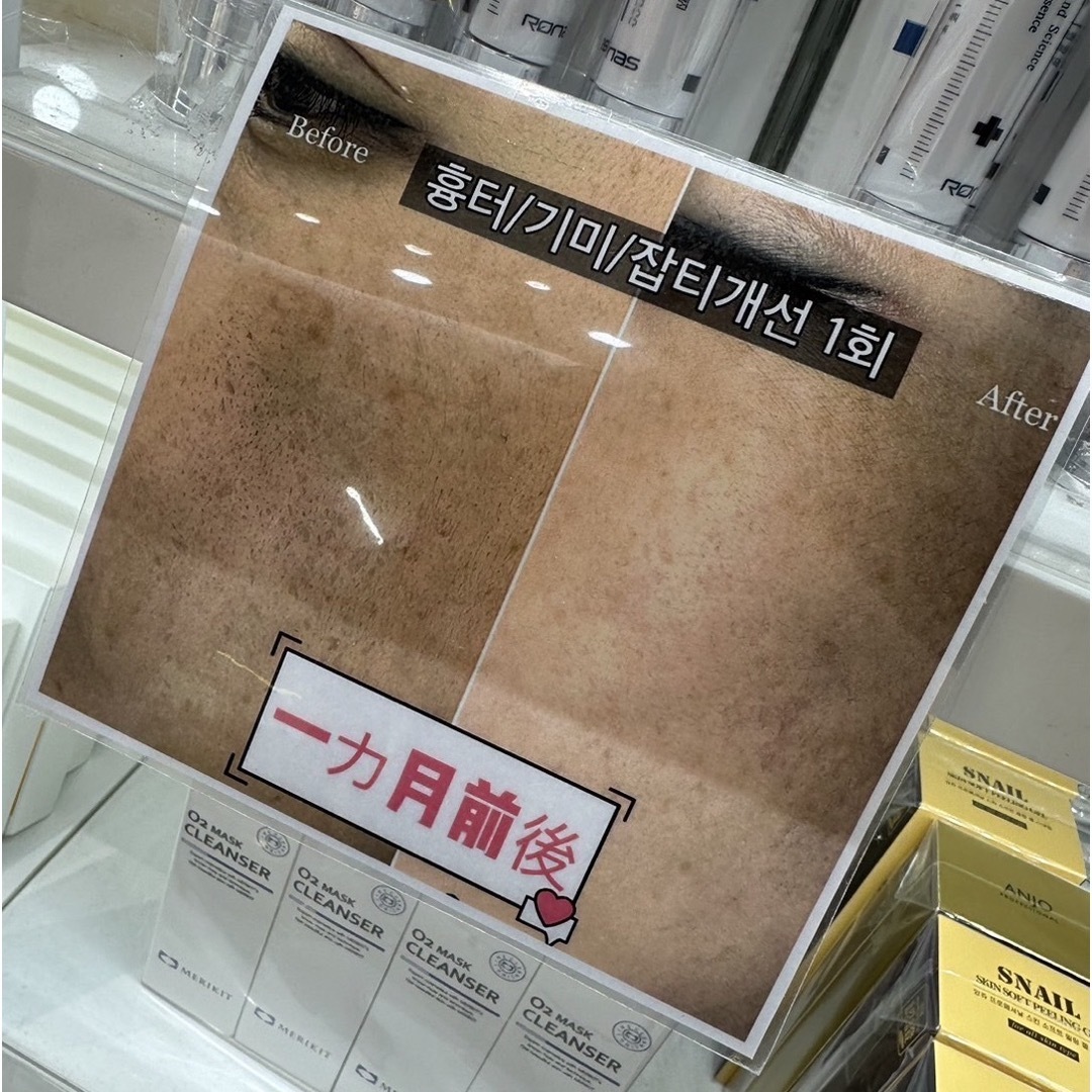 rom&nd - Ronas stem cell tox volume fill 幹細胞の通販 by ちーず's