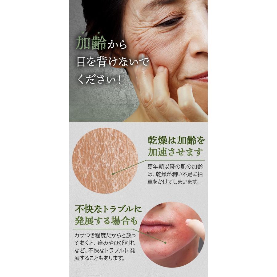 CBD スキンクリーム カンナビジオール 高配合 CBDクリーム くすみ 乾燥