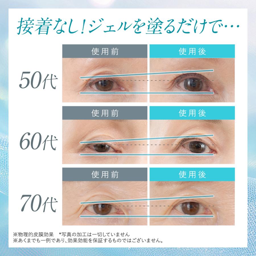 北の快適工房 まぶた たるみ 引き上げ ジェル 「リッドキララ」 アイ