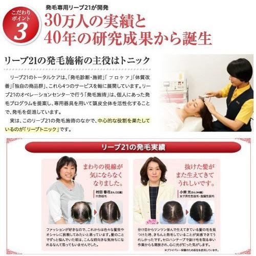 リーブ21 育毛剤 女性用 育毛トニック ヘアトニック 発毛剤 育毛 発毛