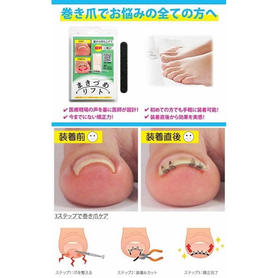 まきづめリフト ヤスリ付 《4本爪、巻き爪 矯正 ワイヤー