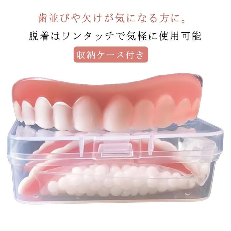 仮歯 つけ歯 美容 義歯 上歯用 下歯用 差し歯 欠け歯 入れ歯 収納