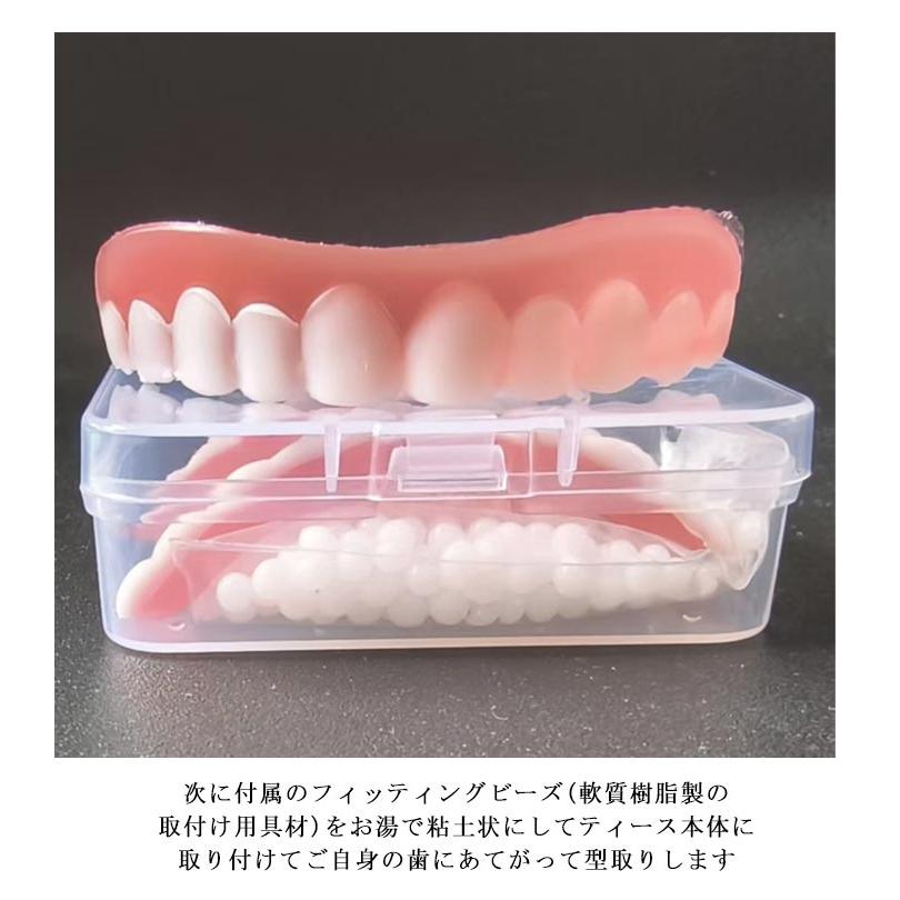 仮歯 つけ歯 美容 義歯 上歯用 下歯用 差し歯 欠け歯 入れ歯 収納