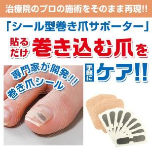 巻き爪 テーピング 巻き爪シール お得な4ヶ月セット ネコポス発送 送料