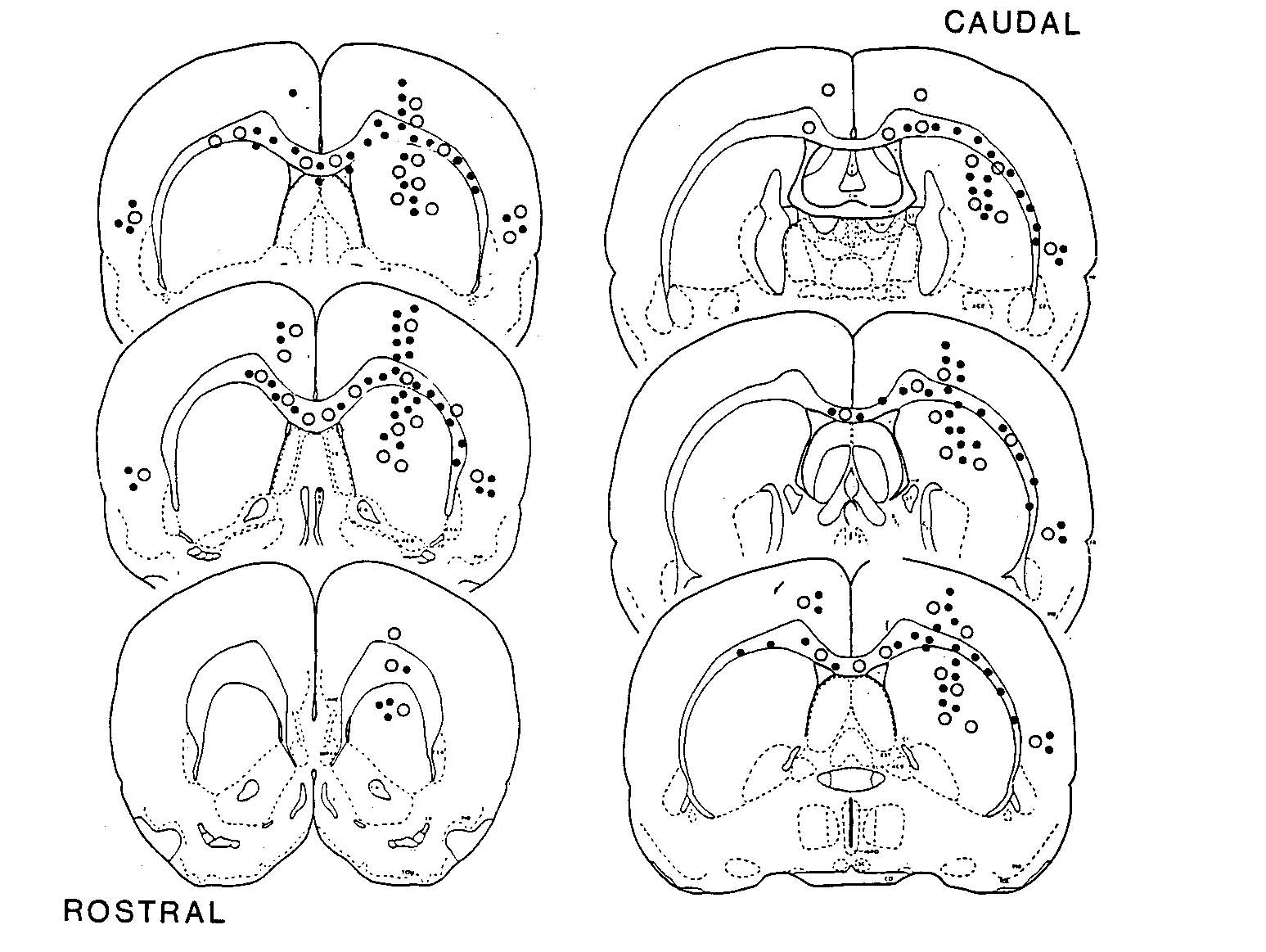 骨髄幹細胞を脳内に始めて投与した論文（Azizi） | 脳外科医 川堀真人