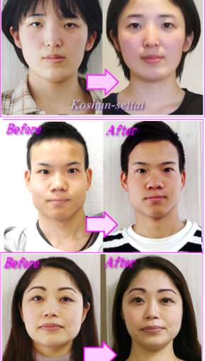 これ絶対やめて！めちゃ顔が歪みます - 札幌 小顔専門弘俊整体院 美容