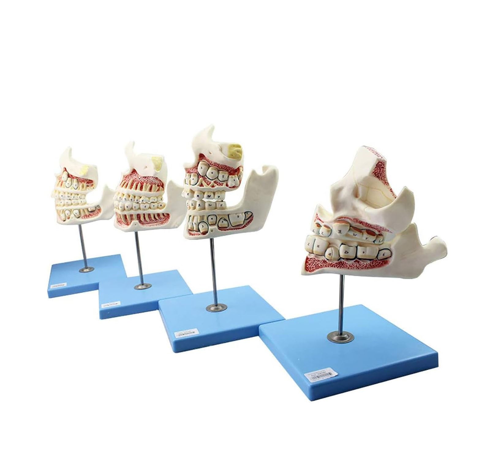 Amazon.co.jp: 歯列模型 乳歯、永久歯、子どもの歯と顎の発達モデル