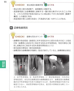 Amazon.co.jp: 歯科国試パーフェクトマスター 歯科放射線学 : 飯久保