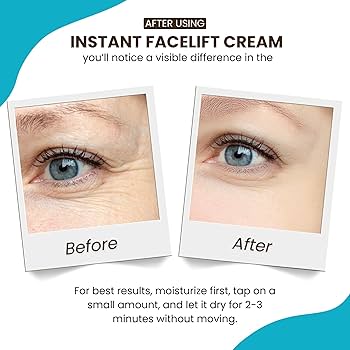 Amazon.com: Instantly Ageless - Instant Face Lift Cream - Skin