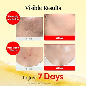 Amazon.com: EQQUALBERRY Vitamin Illuminating Cream – Vitamin C & 5