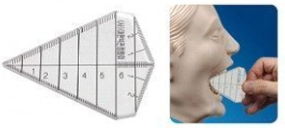 Amazon | ギャグゲージMC※オートクレープ処理不可 | ゲージ・コンパス