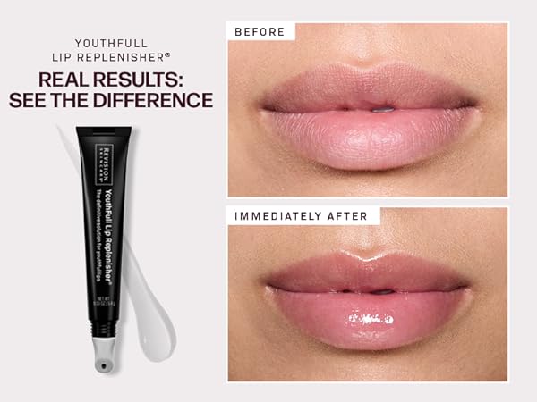 Amazon.com: Revision Skincare YouthFull Lip Replenisher