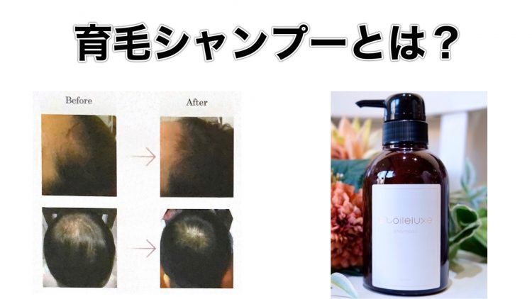 月間50本限定！ヒト幹細胞培養液 イリュージョニストシャンプーの効果