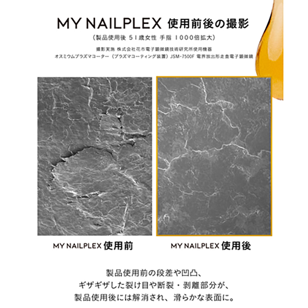 ▽TITANAIL チタネイル マイネイルプレックス 10ml / NESオンライン