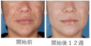 ゼオスキンヘルス｜近鉄生駒駅【奈良】の形成外科・美容皮膚科