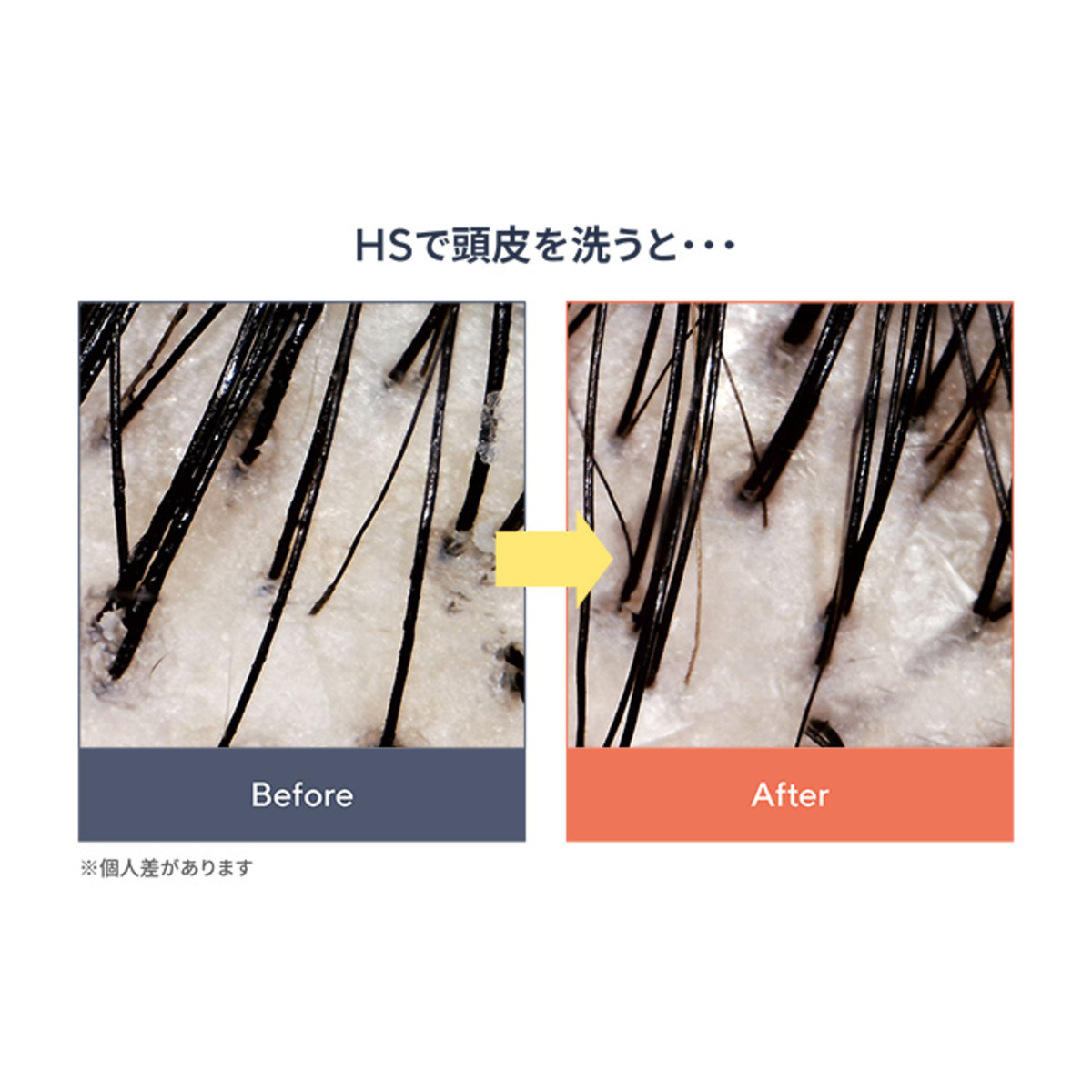 J.avec toi バイタライジングHS-III 3個特別セット ジェイアベック