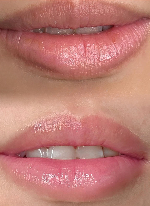 メニュー | ローマピンクジャパン