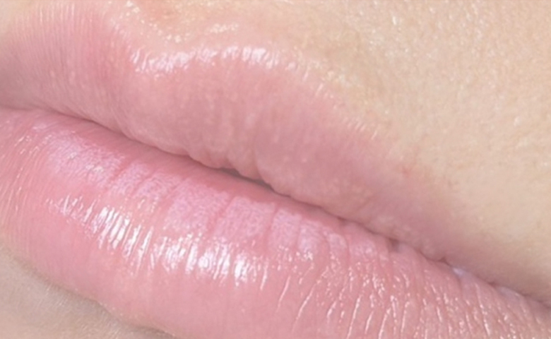 メニュー | ローマピンクジャパン