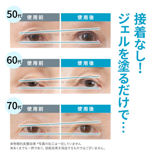 北の快適工房 公式 リッドキララ 3個セット まぶた たるみ アイ