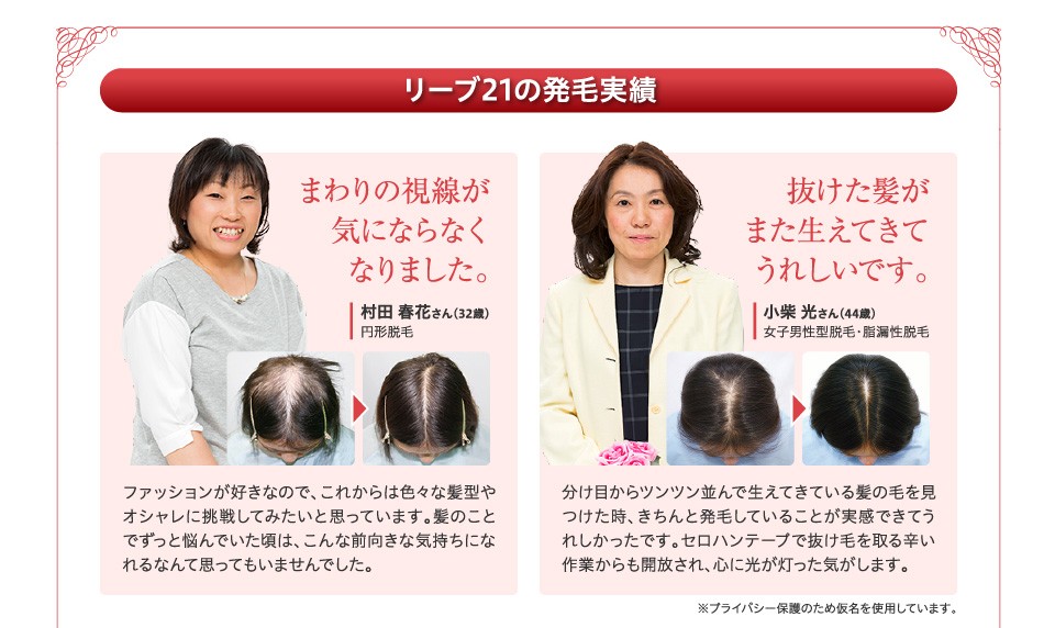 リーブ21 育毛剤 女性用 育毛トニック ヘアトニック 発毛剤 育毛 発毛