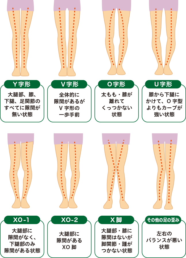 東京渋谷でO脚・X脚矯正専門整体は「渋谷足改善センター宮益坂店」