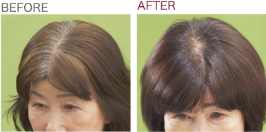 輝髪ペインター - SUNNY PLACE