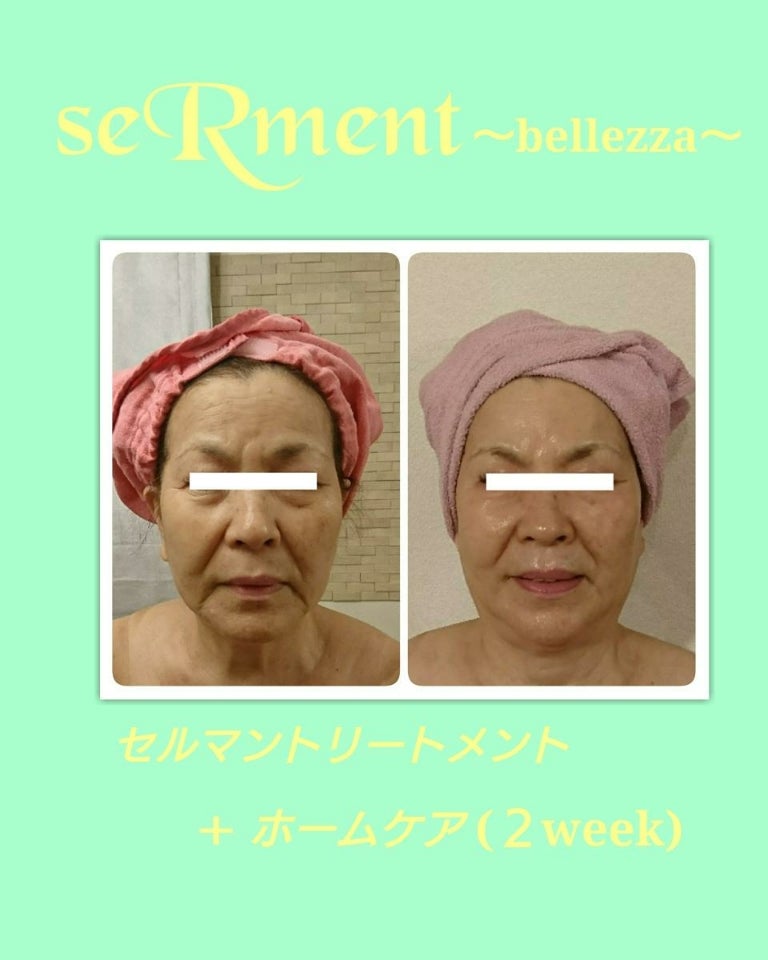 セルマンの嬉しい効果 | bellezza-toyaのブログ