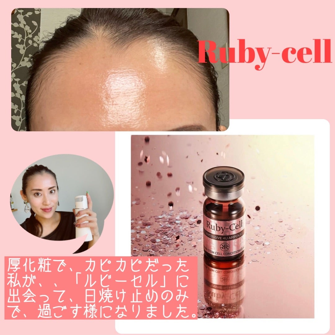 ルビーセル アトラクセラムってなぁに？ | NAILIST kaori~藤枝市駿河台