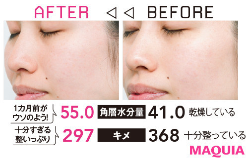 アンチエイジング化粧品の効果やQ&Aまとめ】30日間でしみ、しわはどう