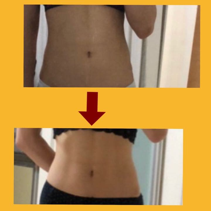 シェイプリフト　EMS ダイエット　スリムビューティーハウス