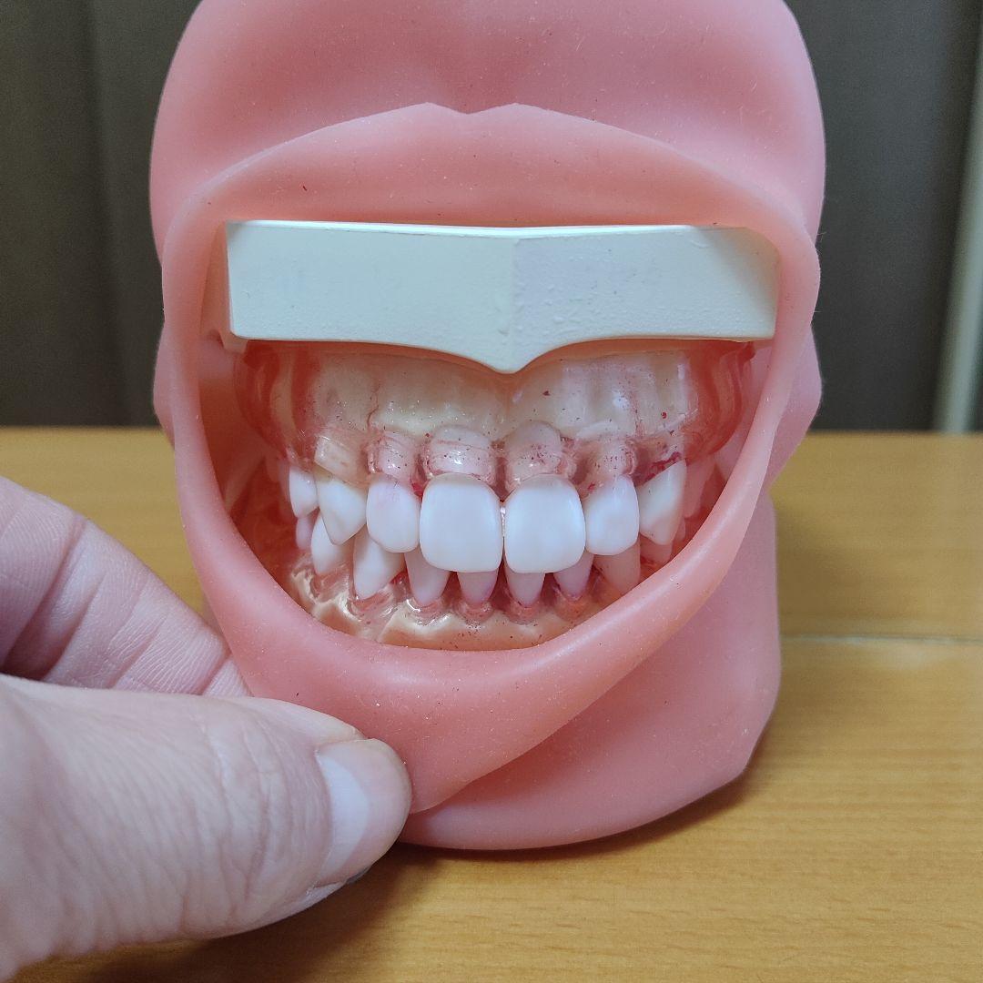歯の模型/歯科衛生士