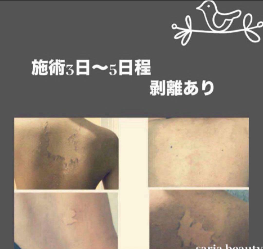 ハーブピーリング　剥離あり　業務用　CICA アロエベラ　和漢　オーガニック