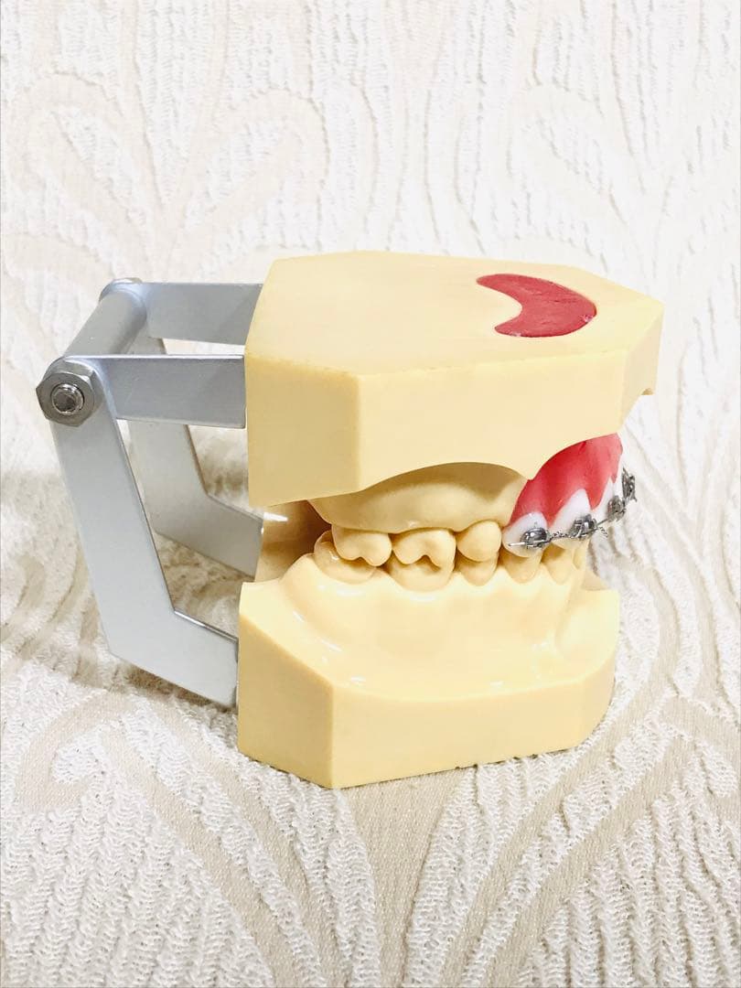 NISSIN DENTAL STUDY MODEL 矯正  歯　模型