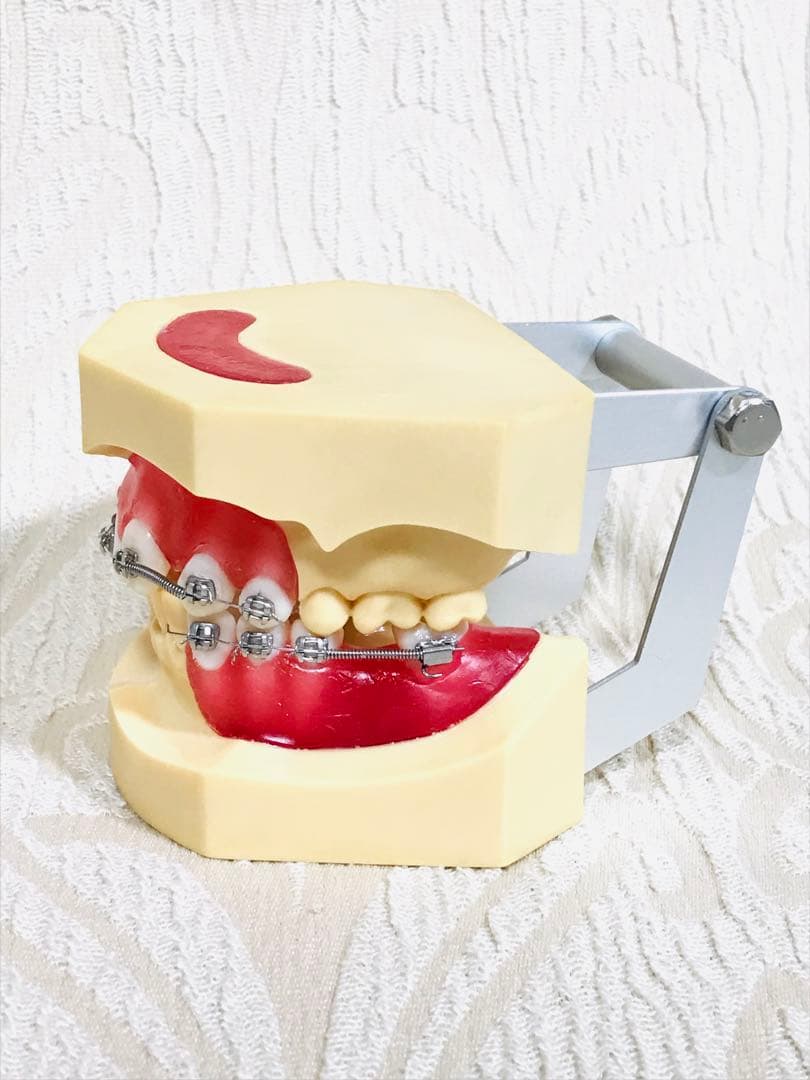 NISSIN DENTAL STUDY MODEL 矯正  歯　模型