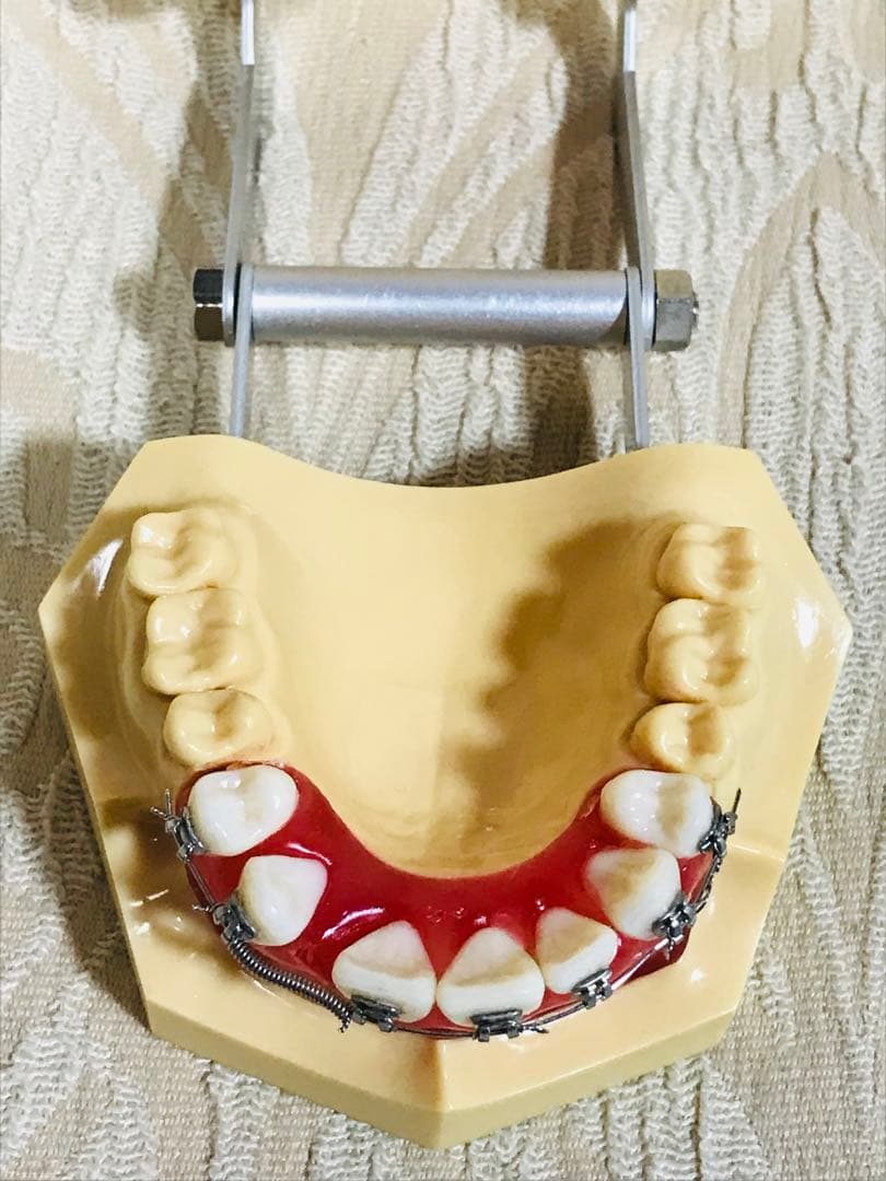 NISSIN DENTAL STUDY MODEL 矯正  歯　模型