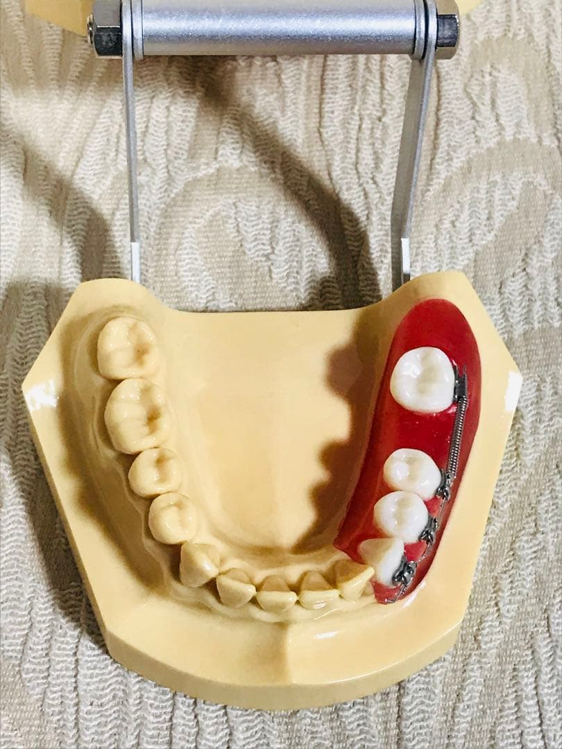 NISSIN DENTAL STUDY MODEL 矯正  歯　模型