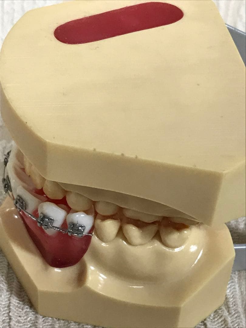 NISSIN DENTAL STUDY MODEL 矯正  歯　模型