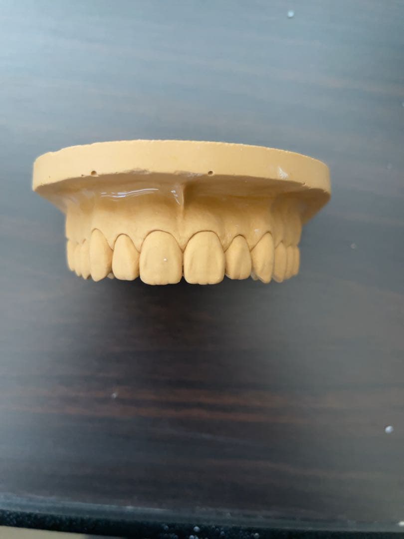 歯科技工　ワセトレ難波氏のサンプル模型です！