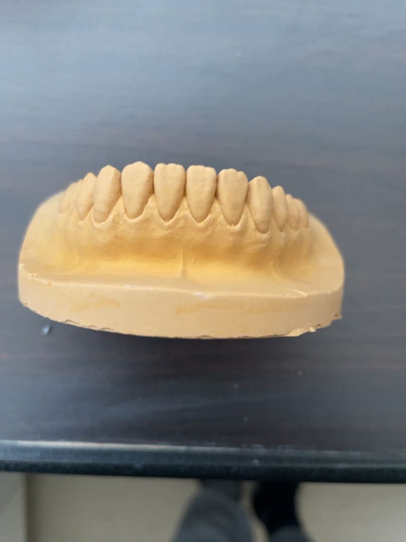 歯科技工　ワセトレ難波氏のサンプル模型です！