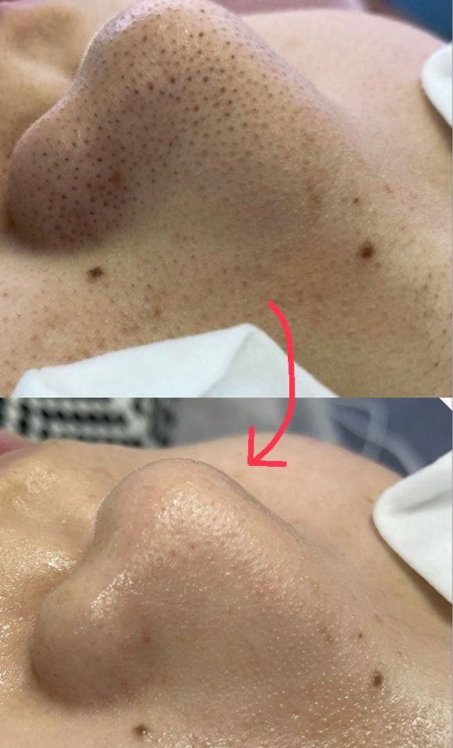 【新品】　プラチナクリーナー　毛穴洗浄用美容液