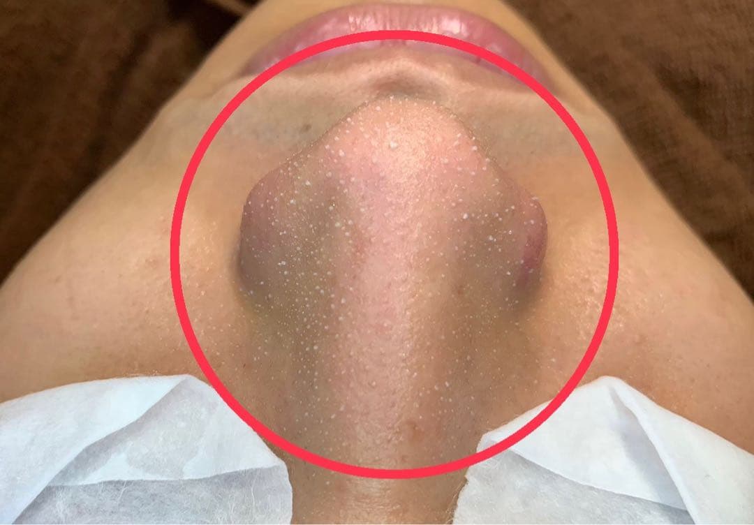 【新品】　プラチナクリーナー　毛穴洗浄用美容液