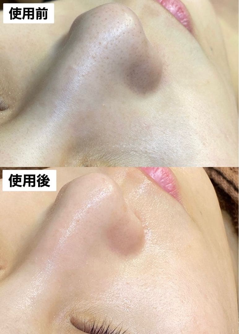 【新品】　プラチナクリーナー　毛穴洗浄用美容液