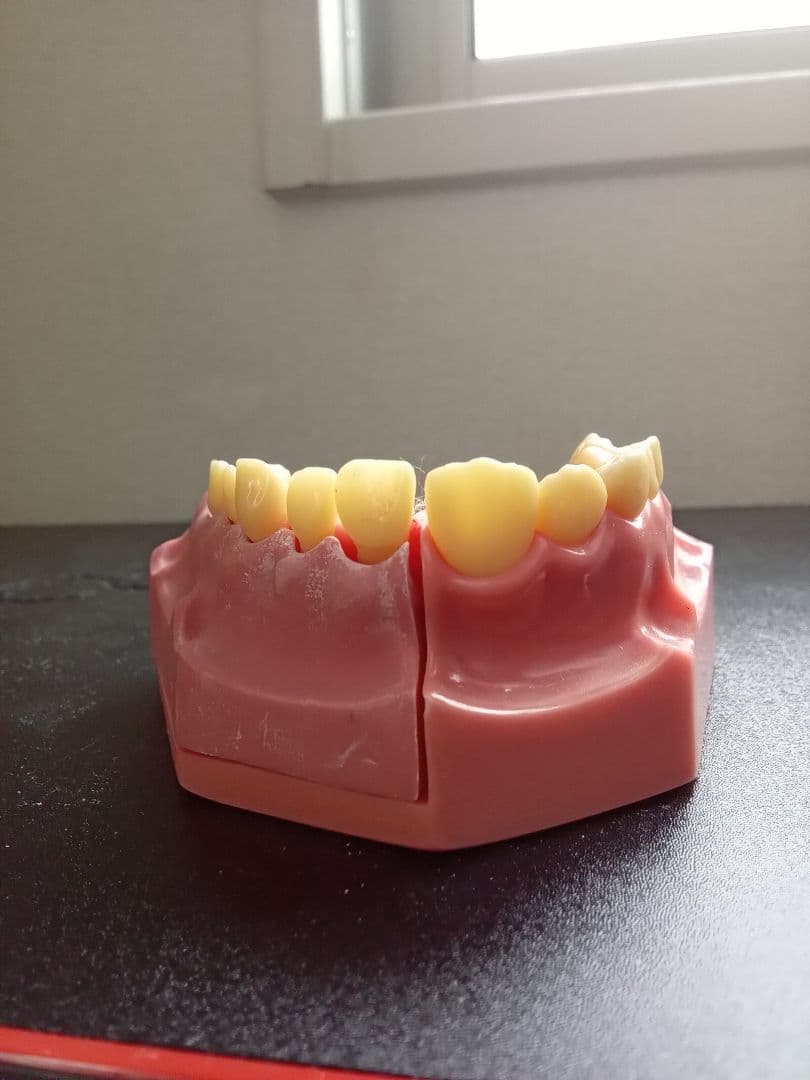 乳歯永久歯交換期模型、永久歯歯列模型