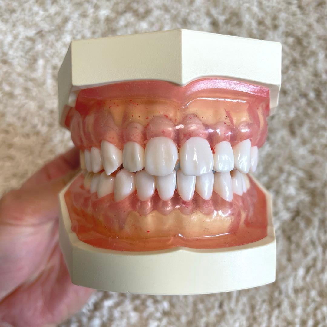 歯科　額模型