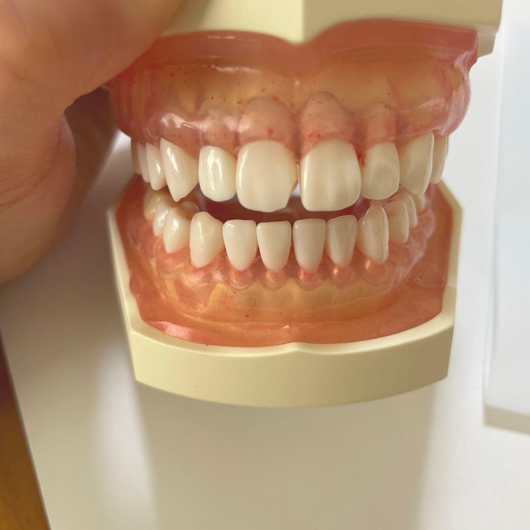 歯科　額模型